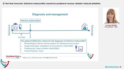 Not that innocent:  Infective endocarditis caused by peripheral venous catheter induced phlebitis.