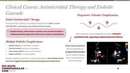 A coronary clue: embolic myocardial infarction unmasks prosthetic valve endocarditis