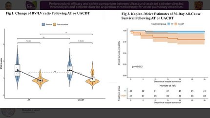 Periprocedural efficacy and safety comparison between ultrasound‑assisted catheter‑directed thrombolysis and catheter‑directed mechanical thrombectomy for acute pulmonary embolism