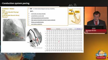 Presentation thumbnail