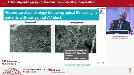 Presentation thumbnail