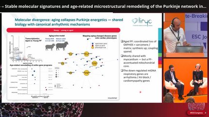 Stable molecular signatures and age-related microstructural remodeling of the Purkinje network in sheep and human hearts