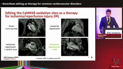 Gene editing and gene therapies to cure cardiovascular diseases