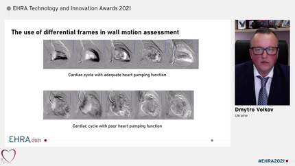 Presentation thumbnail
