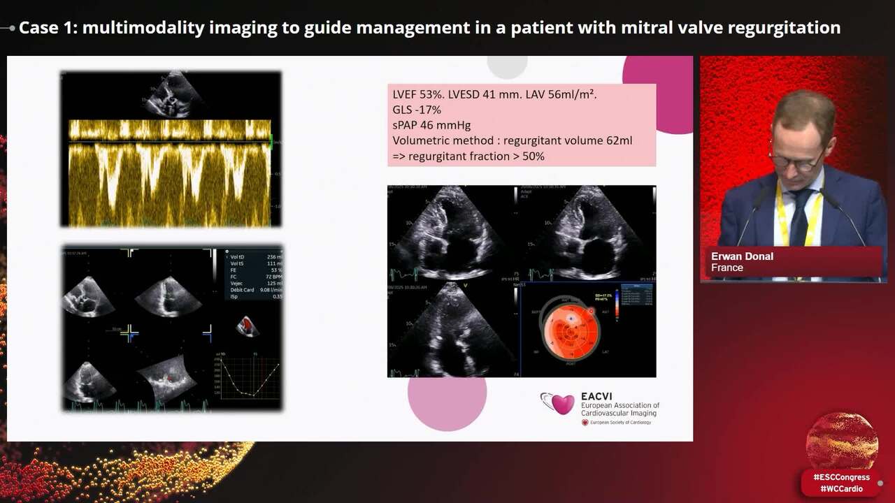 Case 1: multimodality imaging to guide management in a patient with mitral valve regurgitation