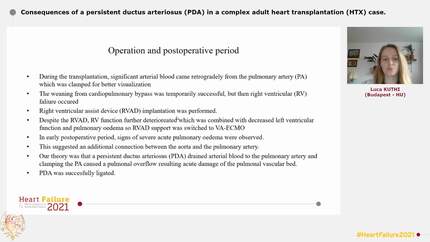 Consequences of a persistent ductus arteriosus (PDA) in a complex adult heart transplantation (HTX) case.