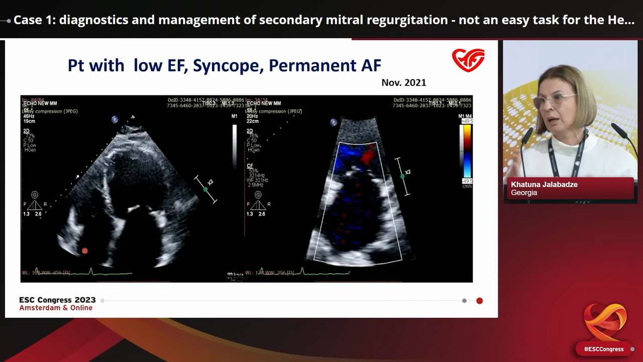 Case 1: diagnostics and management of secondary mitral regurgitation - not an easy task for the Heart Team in Georgia