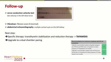 Presentation thumbnail