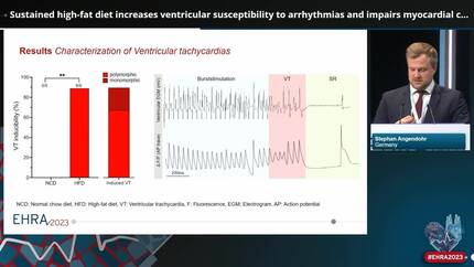 Sustained high-fat diet increases ventricular susceptibility to arrhythmias and impairs myocardial calcium cycling