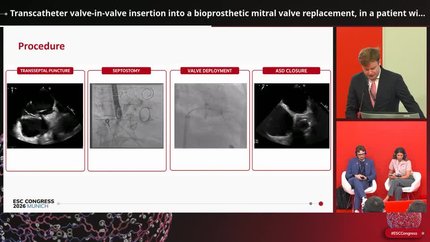 Presentation thumbnail