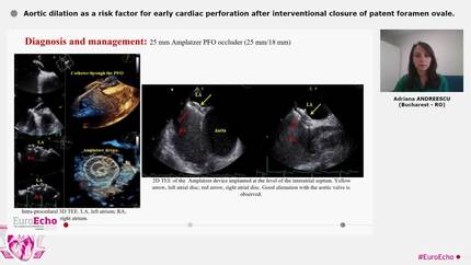 Aortic dilation as a risk factor for early cardiac perforation after interventional closure of patent foramen ovale.