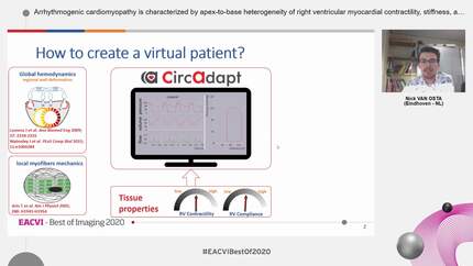 Arrhythmogenic cardiomyopathy is characterized by apex-to-base heterogeneity of right ventricular myocardial contractility, stiffness, and mechanical delay: a patient-specific modeling study