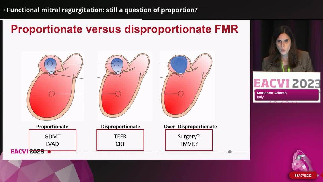 ESC 365 Functional mitral regurgitation still a question of