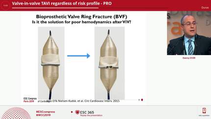 Valve-in-valve TAVI regardless of risk profile - PRO