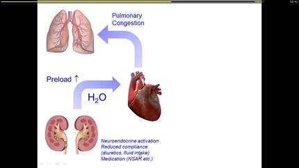 Presentation thumbnail