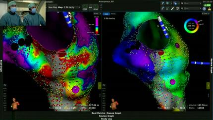 Live Case from Linz: AT post ASD surgery / Live Case from Leipzig: AF ablation. - Part 2.