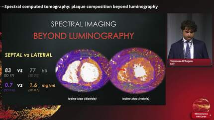 Coronary computed tomography in chronic coronary syndrome: innovations in imaging and functional assessment