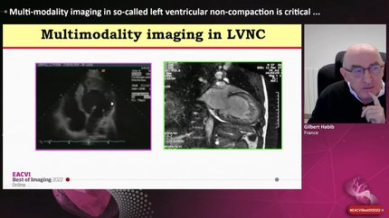 Presentation thumbnail