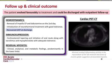 Giant cell myocarditis: a classical condition in the modern age of medicine