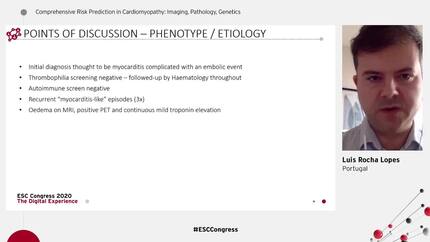 Case 1 - Comprehensive risk prediction in the thickened heart.