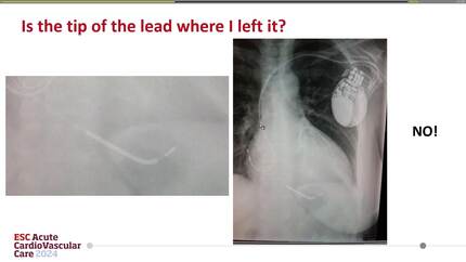 Presentation thumbnail