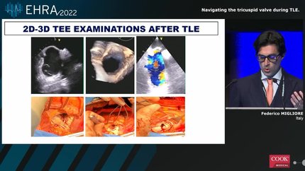 Presentation thumbnail