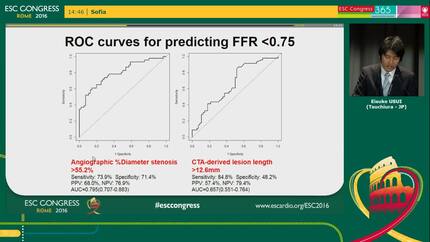 Hybrid approach by the combination of multidetector computed tomography and invasive coronary angiography with fractional flow reserve to identify physiologically significant coronary stenosis