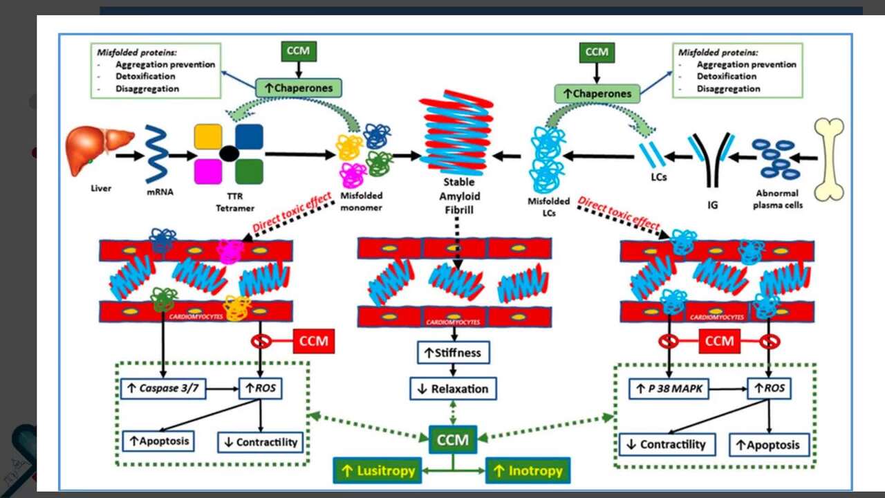 CCM efficacy in ATTR cardiomyopathy with mr to r EF and nyha III orIV