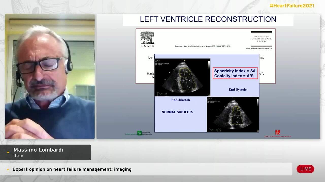 Expert opinion on heart failure management: imaging