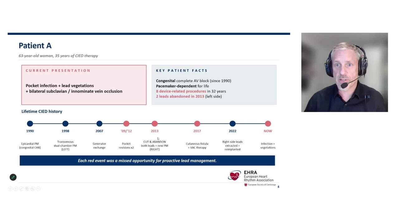 Smart choices in lead management: balancing risks, selecting patients, and ensuring cost-effectiveness
