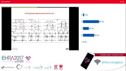 Electrophysiologic assessment of accessory pathway conduction properties.
