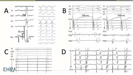 Presentation thumbnail