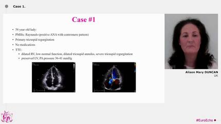 How to select the candidates for tricuspid valve interventions (Voting session)
