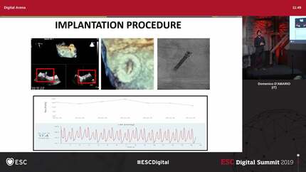 Presentation thumbnail