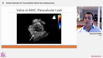 Presentation thumbnail