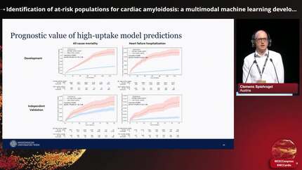 Identification of at-risk populations for cardiac amyloidosis: a multimodal machine learning development and validation study