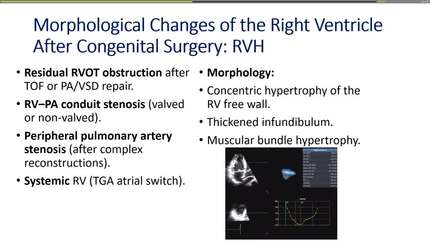 Presentation thumbnail