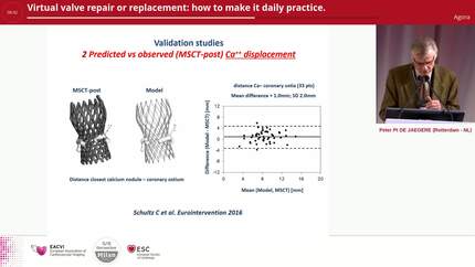 Virtual valve repair or replacement: how to make it daily practice.