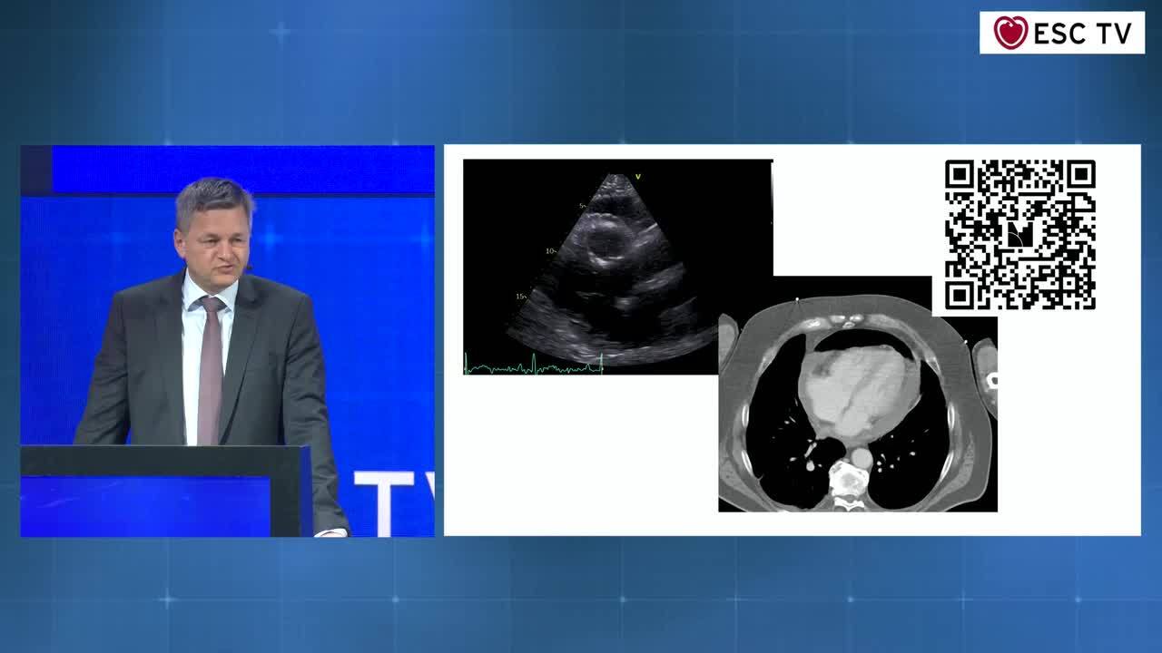 The Great (Interactive) Cardiac Imaging Extravaganza