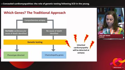 Concealed cardiomyopathies: the role of genetic testing following SCD in the young.