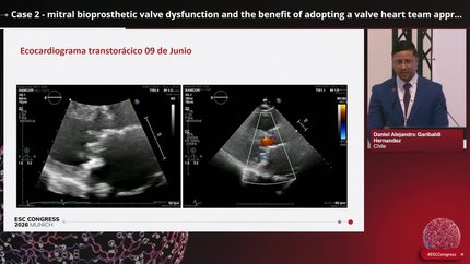 The impact of ESC guideline- implementation in the management of complex valvular heart disease: insights from Chile