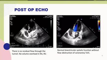 Presentation thumbnail