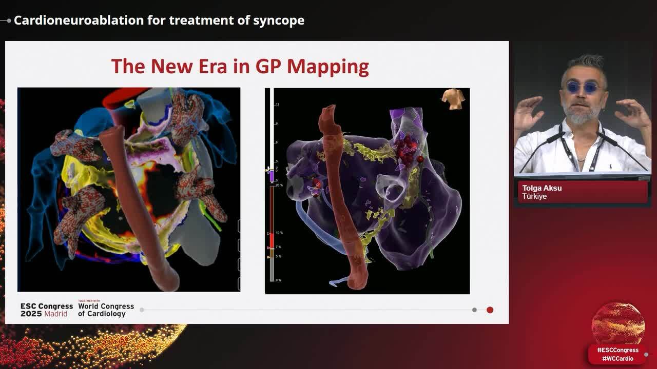 Management of syncope: from pills to wires