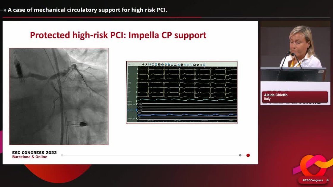 ESC 365 - A case of mechanical circulatory support for high risk PCI.