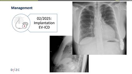 Presentation thumbnail