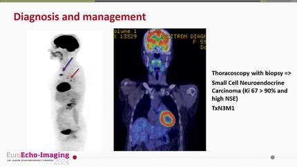 Presentation thumbnail