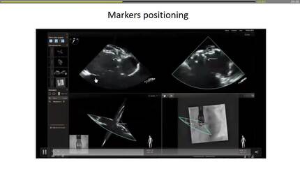 Presentation thumbnail