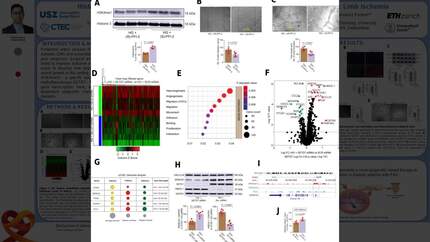 Histone Mono-methylation by SETD7 Orchestrates Angiogenic Response in Diabetic Limb Ischemia