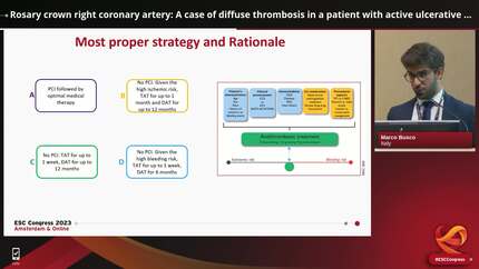 Rosary crown right coronary artery: A case of diffuse thrombosis in a patient with active ulcerative colitis