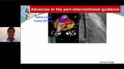 Presentation thumbnail